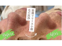 ルー(Lu)/【大人気】毛穴洗浄コース