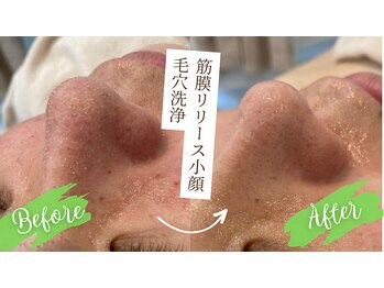 ルー(Lu)/【大人気】毛穴洗浄コース