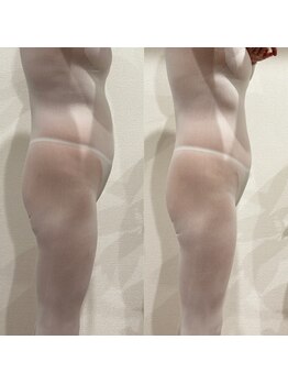 ミ ライト(m light)/全身痩身集中ケアロング90分