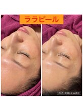 ビューティーサロン キャンディ 海老名(Candy)/