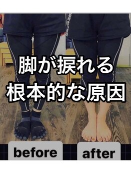 カワル整体 上通り院/脚が捩れる根本的理由
