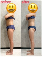 トータルビューティー ミミ(Total Beauty mimi)/ウエストも下半身もスッキリ♪