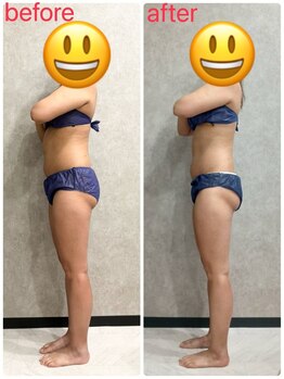 トータルビューティー ミミ(Total Beauty mimi)/ウエストも下半身もスッキリ♪