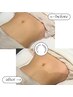 腸活◎【腸もみケア】ぽっこりお腹も解消！美腸活トリートメント　30min