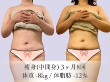 ベルペール(Belle perle)/【痩身】インドエステ