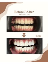 セルフダック 滋賀守山店(SELFDUCK)/ビフォーアフター