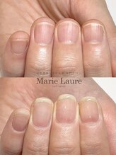 マリーロール 梅田店(Marie Laure)/自爪育成/深爪矯正/ネイルケア