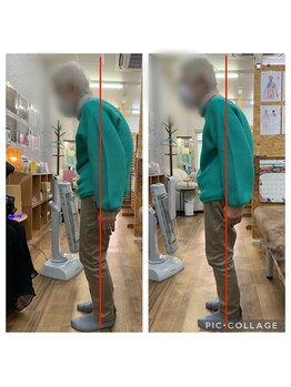 カインド整体院(KiND整体院)/首痛と腰痛が楽になりました!