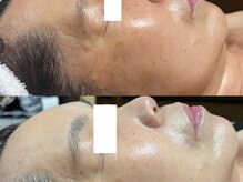 ミルジュ(MiLuJu)/タラソトリートメント