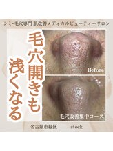 ストック(stock)/