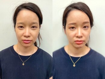 アトリエ スタンズ(atelierSTAENS)/20代の方ビフォー＆アフター