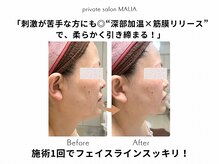 マリア(MALIA)の雰囲気（切らない小顔ケア。柔らかい自然な仕上がり！熱×圧で土台から♪）