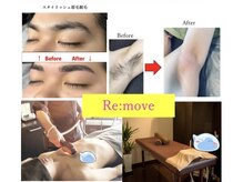 リムーヴ(Re:move)