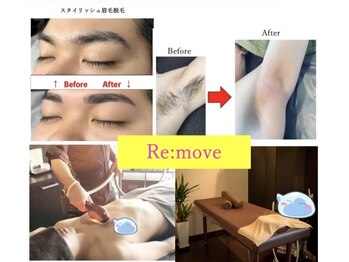 リムーヴ(Re:move)