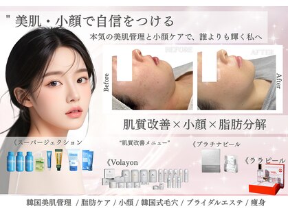 リアム(LiAm)の写真