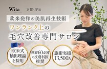 ウィタ(Wita)