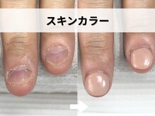 ブルームーンネイルズ(BLOOMOON.nails)/スキンカラー