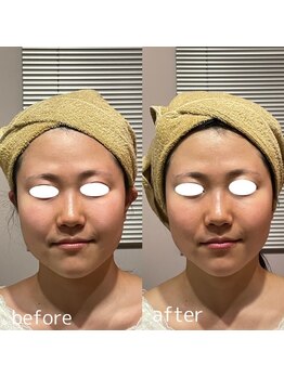 クーラ テュセ(Coeur la Tusais)/水素の力で透明感+引き締め効果