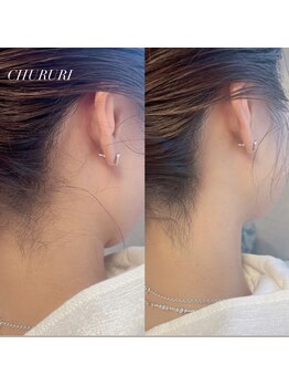 チュルリ 新町店(Chururi)/うなじ脱毛