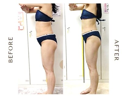 アヤエステティックサロン 綱島店(AYA)の写真