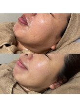 アンドミー(and me)/鹿児島/唐湊/トータルケア