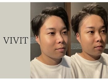 ビビット 久宝寺店(VIVIT)/リフトアップ/フェイシャル/小顔