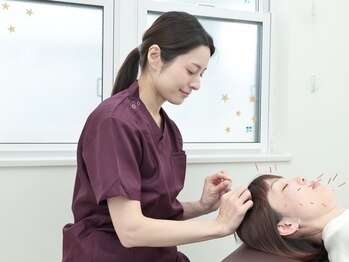 加古川鍼灸整骨院の写真/美容鍼を受けるなら加古川鍼灸整骨院へ!鍼は痛そう、初めてで怖い、、そんな方でもぜひご来院を!