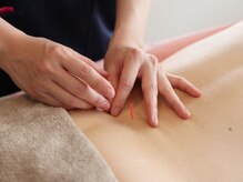 ときのはり鍼灸院(TOKINOHARI)の雰囲気（国家資格あり！鍼とお灸を使い分け女性特有のお悩みにアプローチ）