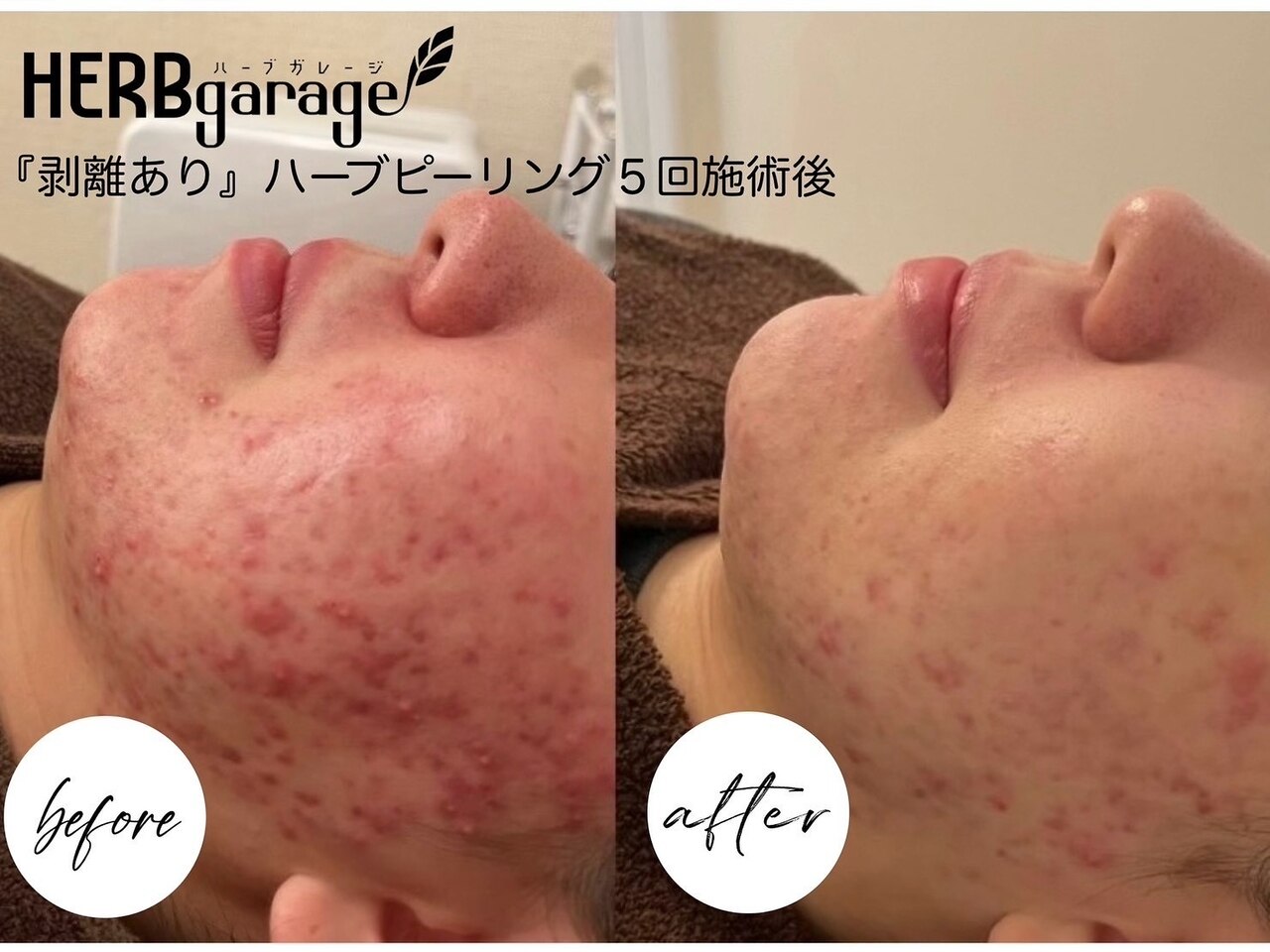 ハーブガレージ 心斎橋店(HERB garage)｜ホットペッパービューティー