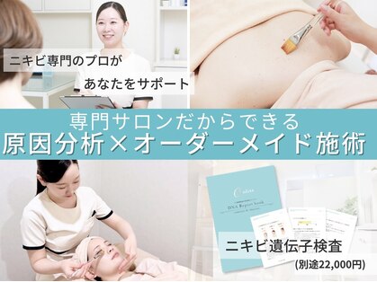 オリス 名古屋店(oliss)の写真