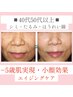 【40代50代年齢肌★エイジングケア】シワ・たるみ肌がふっくらツヤ肌へ変化♪