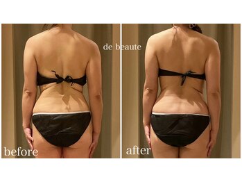 ドゥ ボーテ(de beaute)/de beaute