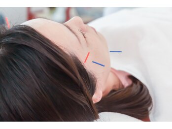 美容鍼灸salonまつもと/