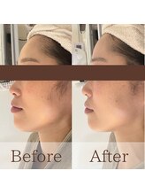 凪眠/小顔リンパフェイシャルの効果35