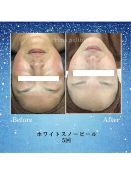 プリマプリート 各務原店/紫外線に負けない肌ケア！