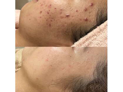 ハンナ(Hanna)の写真