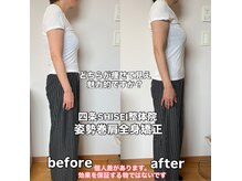 四条シセイ整体院(SHISEI整体院)の雰囲気(頭蓋、姿勢、巻肩、骨盤変わると、楽さと見た目と雰囲気が変わる)