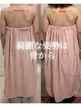 ロココ 豊田店(Rococo)/ビフォーアフター(肩甲骨の開き)