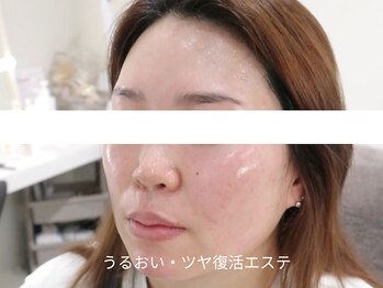 マイ フェア レディ(MY FAIR LADY)/うるおい・ツヤ復活エステ