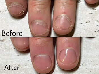 アルカナ(ARCANA)/スタンダードコース初回￥6,000