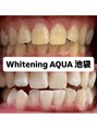 アクア 池袋店(AQUA) ホワイトニング/池袋/美白/ホワイトニング/ブライダル/東京