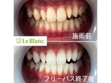 ルブラン 奈良店(Le Blanc)/ご新規様増えてます！！
