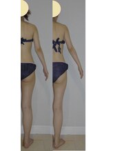 アルマ 芦屋(ALMA)/右だけの比較☆たった1日です