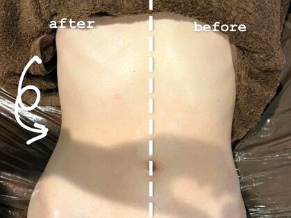 アヤエステティックサロン 綱島店(AYA)の写真