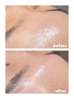 プティジョナ(Petit Jona)/フェイシャルwaxでトーンUP♪