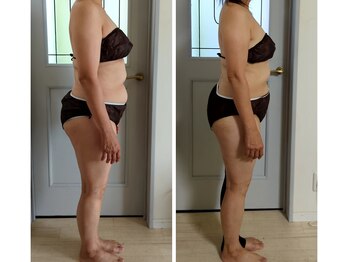 ヨサパーク アカーシャ(YOSA PARK AKASHA)/4回の施術での変化