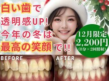 LBSホワイトニング 新宿店