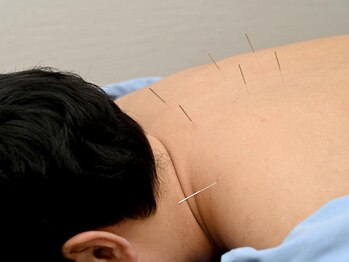 たくみ整骨院 綱島西口院/整体/鍼灸/美容鍼/マッサージ