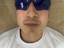 ナニロア(nani loa)