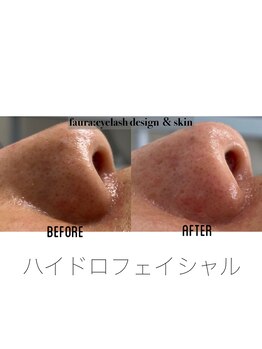 ファウラ(faura:)/ハイドロフェイシャル